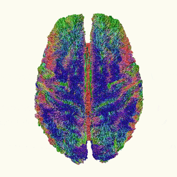 a gif of a pink brain slowly showing the underlying colourful tracts